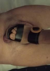 40αρα , για μασάζ προστάτη 6997824615 - Κατεχάκη 